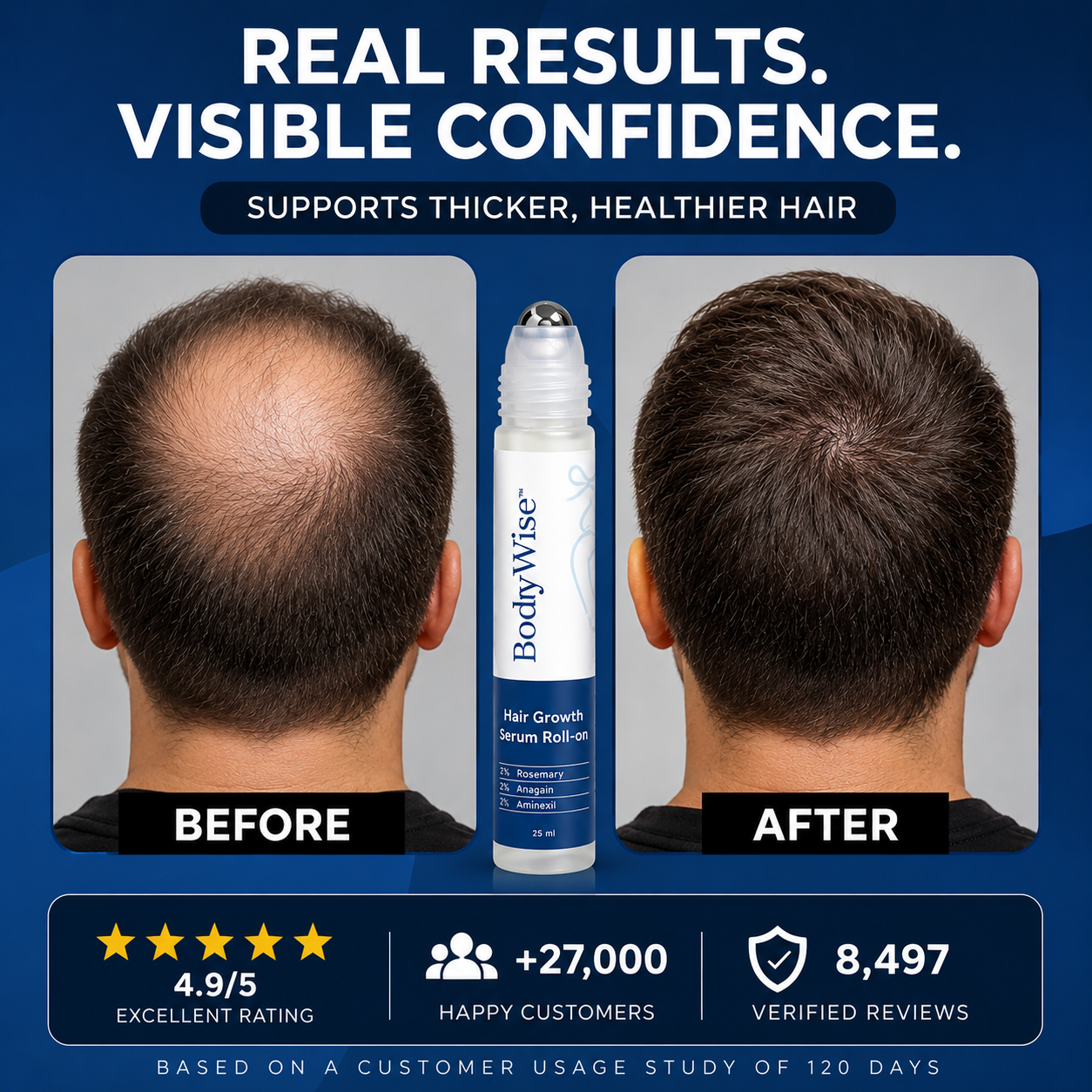 Bodywise™ | Hair Growth Roll On Serum