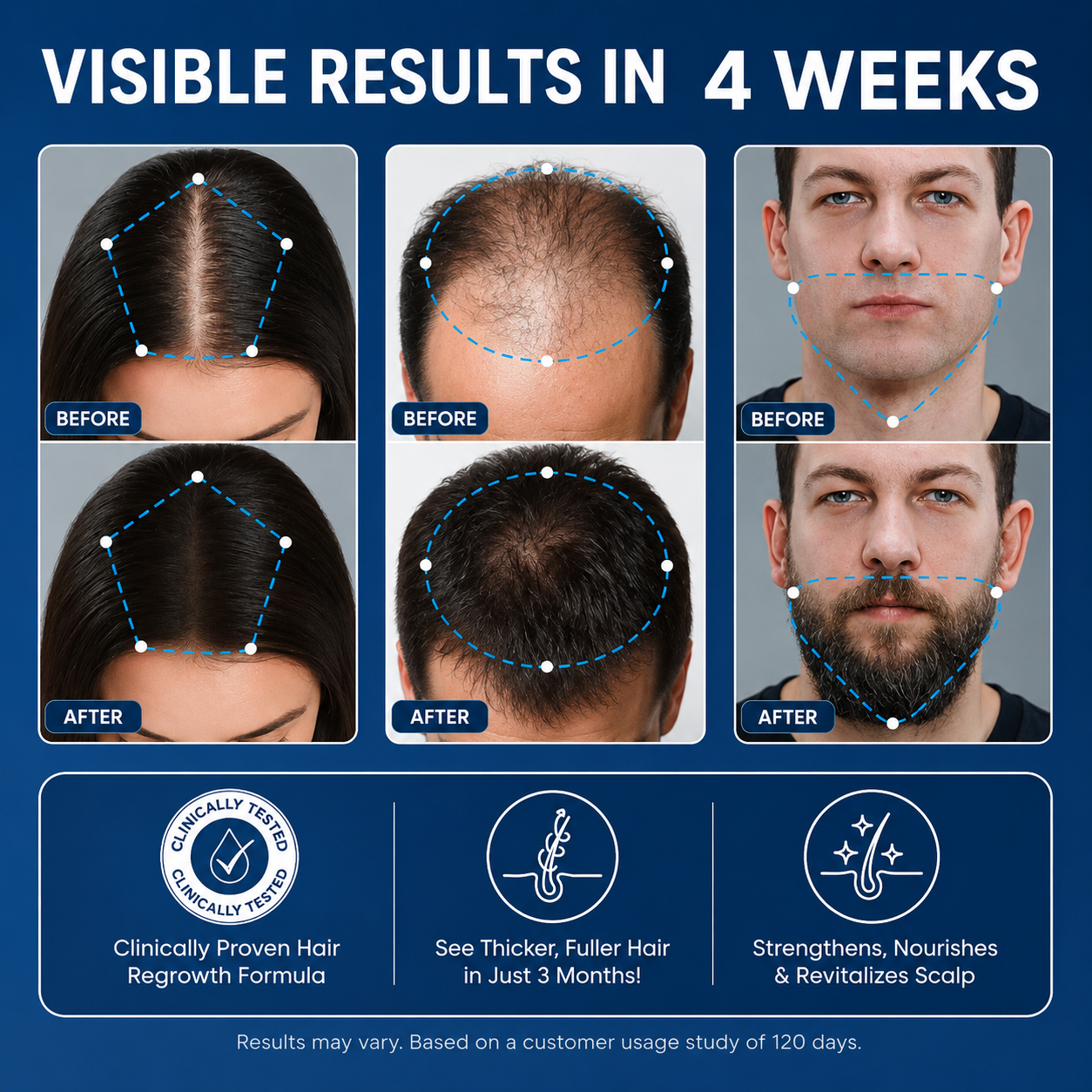 Bodywise™ | Hair Growth Roll On Serum