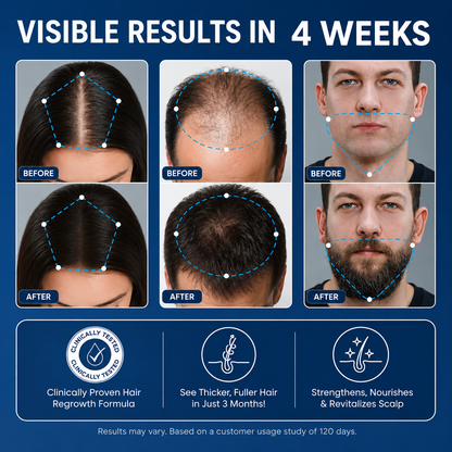 Bodywise™ | Hair Growth Roll On Serum